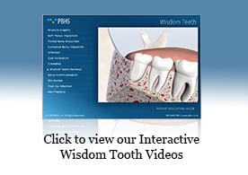 Wisdom Teeth Presentation
