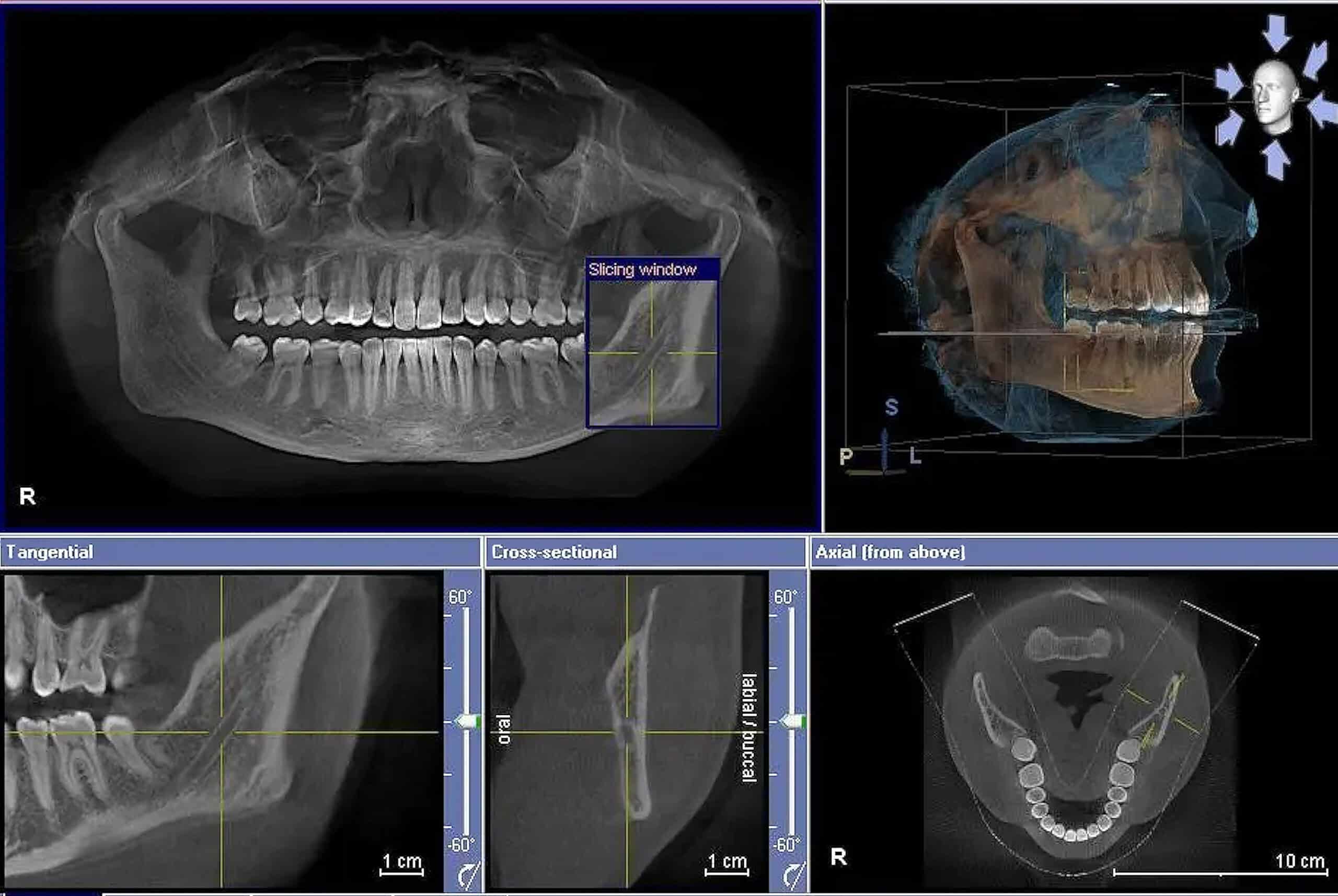 CBCT Image