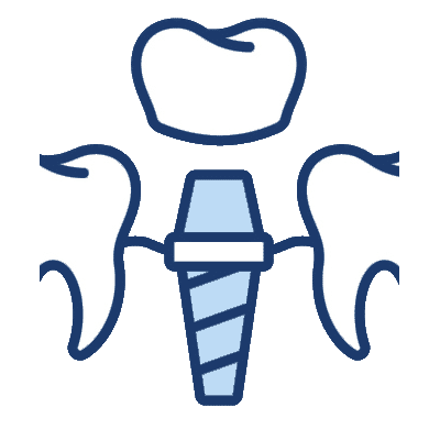 Illustration of Implants