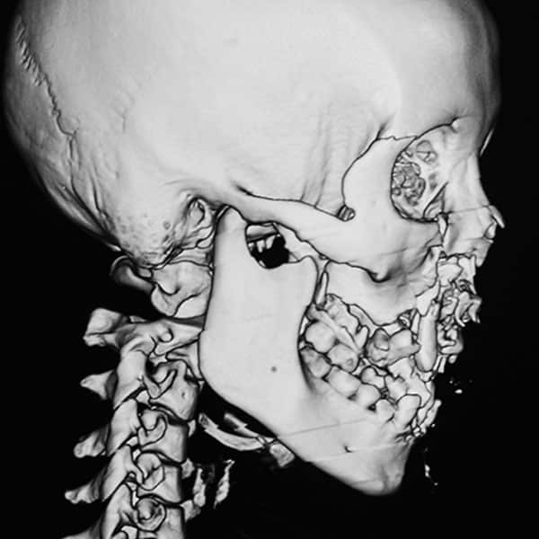 Side View of 3D image